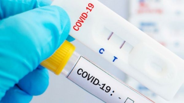 OMS recomienda pruebas de autodiagnóstico para detectar Covid-19